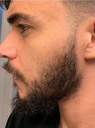 Before and after comparison of a beard growth journey with 'beardjourney' hashtag.