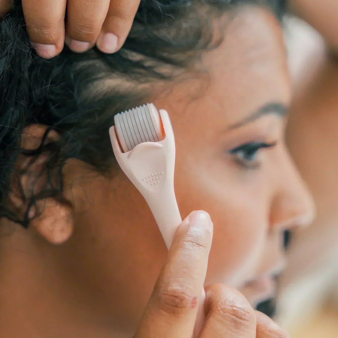 Derma Roller Microneedling for thinning hair before and after results