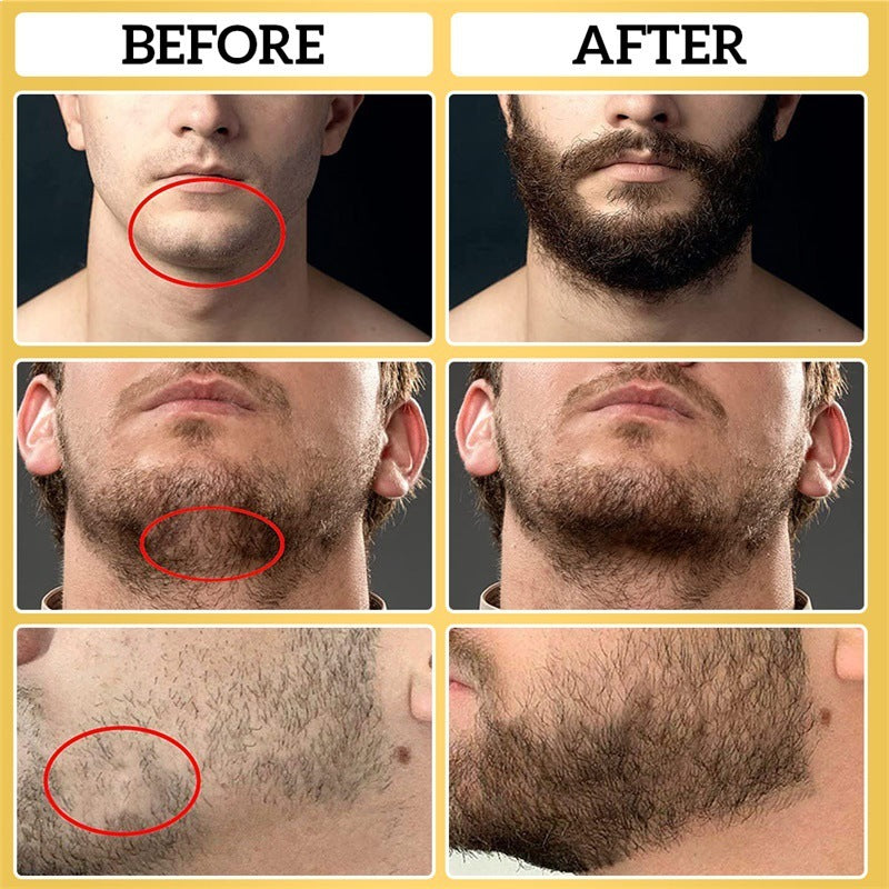 GLOW ROLLER™ Men’s Beard Growth Combo Pack – Derma Roller & Care Kit - The Glow Roller
